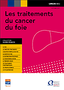 Les traitements du cancer du foie Image 1